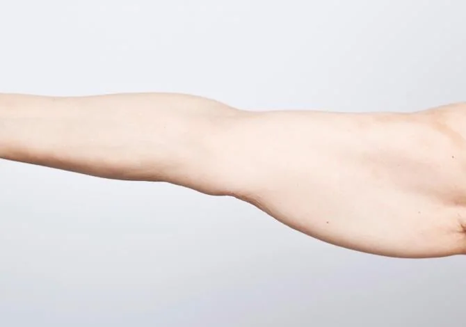 Brazo, antes